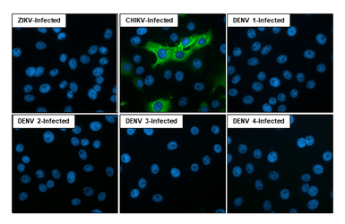 Anti-Chikungunya virus E1 antibody [HL2069] used in Immunocytochemistry/ Immunofluorescence (ICC/IF). GTX637973